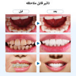 دستگاه شست و شو و جرم گیر دندان برقی مدل IPX7