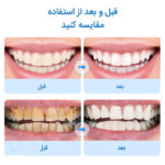 دستگاه شست و شو و جرم گیر دندان برقی مدل IPX7