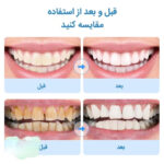 مسواک برقی مدل toothbrush