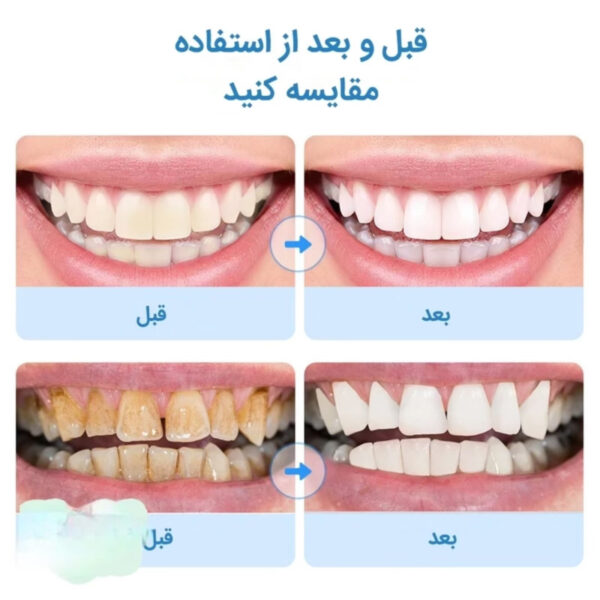مسواک برقی مدل toothbrush