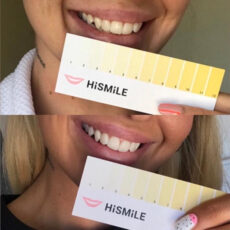 دستگاه سفید کننده دندان های اسمایل مدل 2022