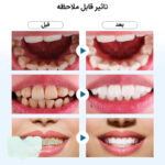 مسواک برقی مدل toothbrush