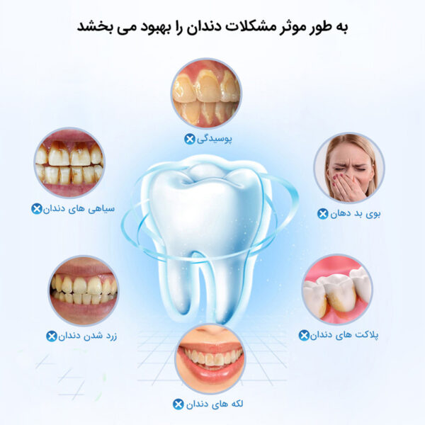 دستگاه شست و شو و جرم گیر دندان برقی مدل IPX7
