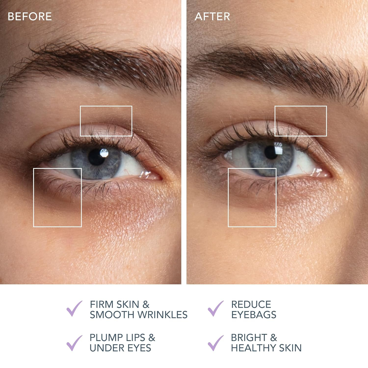 ماساژور برقی فورئو مدل Bear 2 Eyes