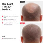 ماساژور برقی مدل Infrared