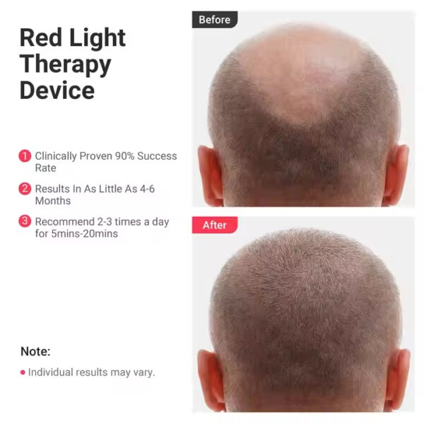 ماساژور برقی مدل Infrared