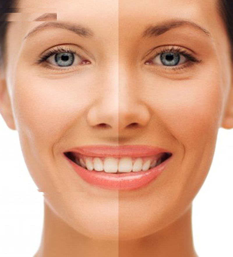 پنکیک برنزه کننده پرستیژ مدل مینرال شماره MBZ-01