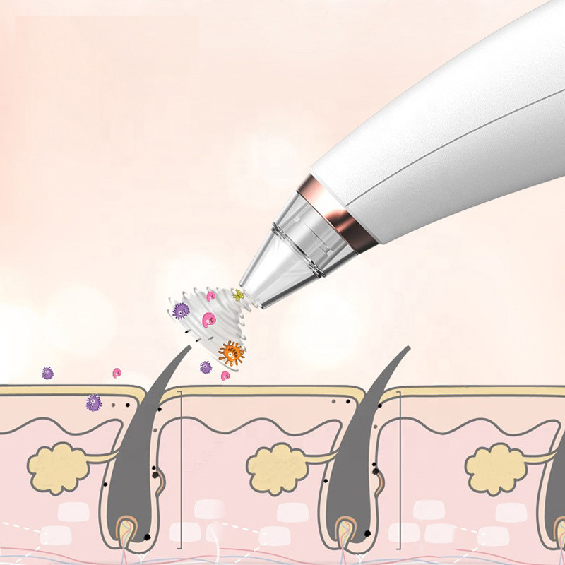 میکرودرم خانگی مدل MCOO4