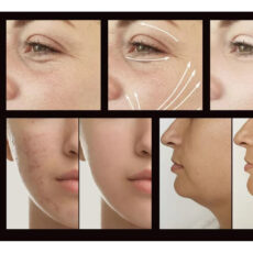 دستگاه جوانسازی هایفرکوئنسی مدل LZ-006A