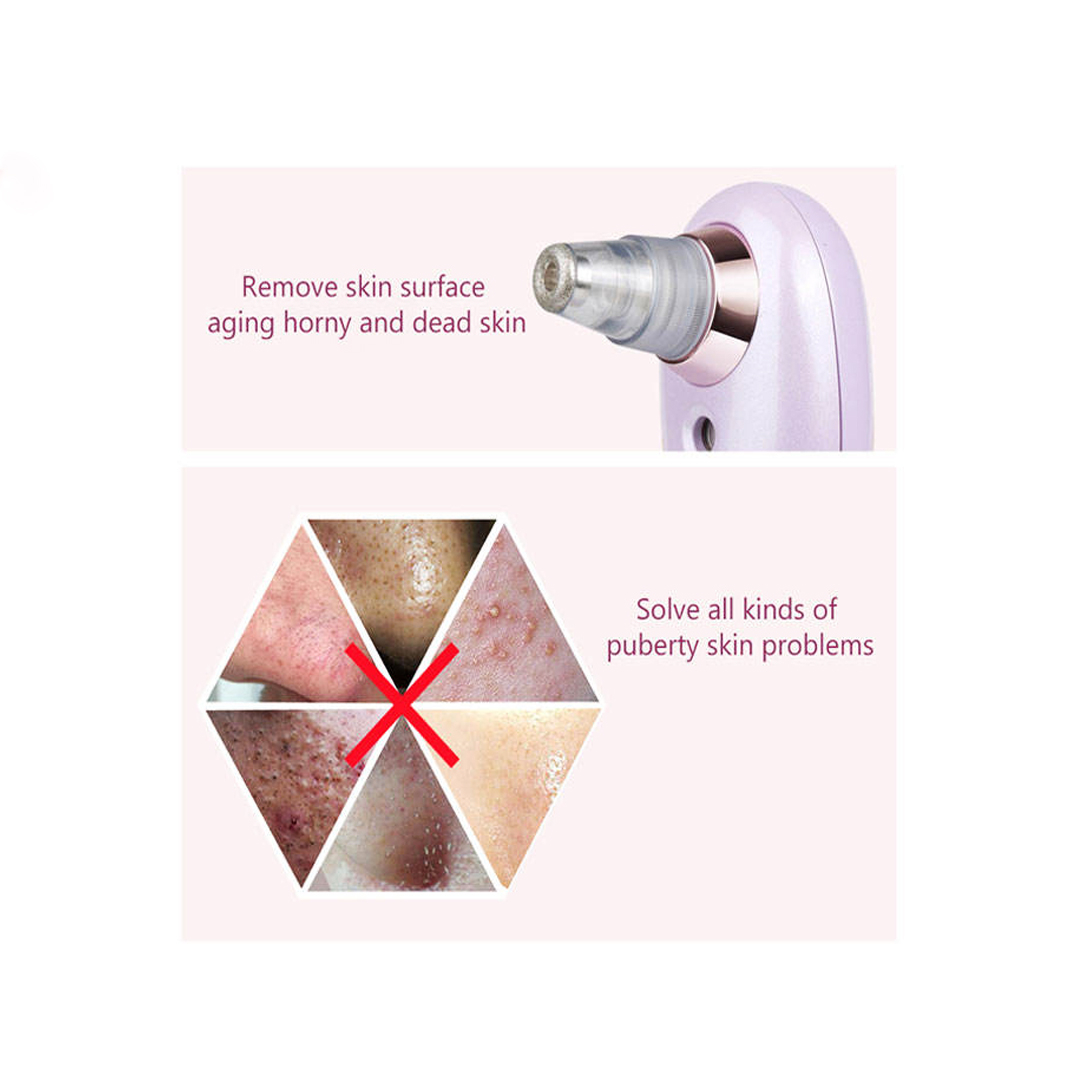 میکرودرم باراباس نانو مدل 2700