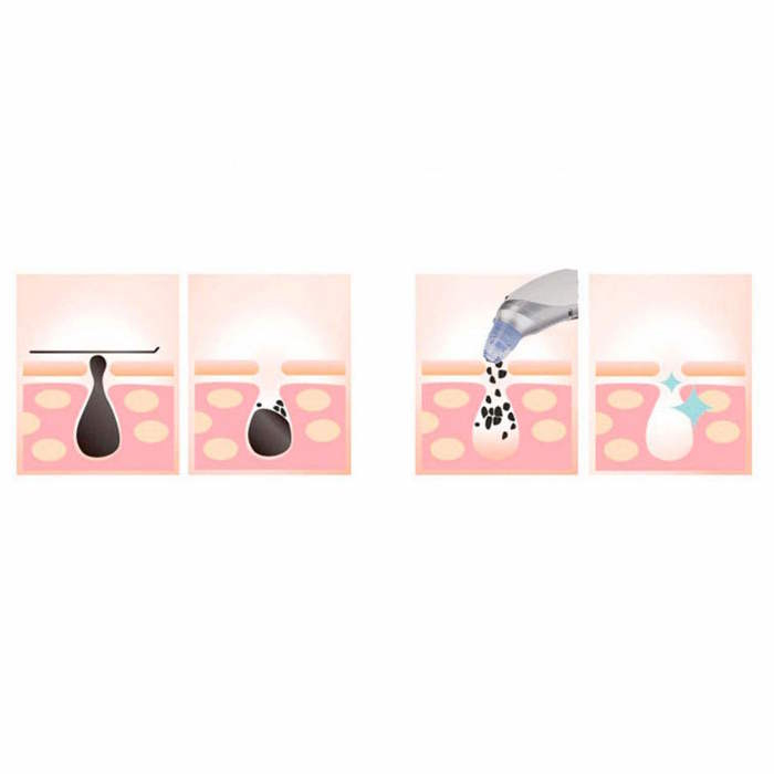 میکرودرم گلویش استایل مدل MT-84