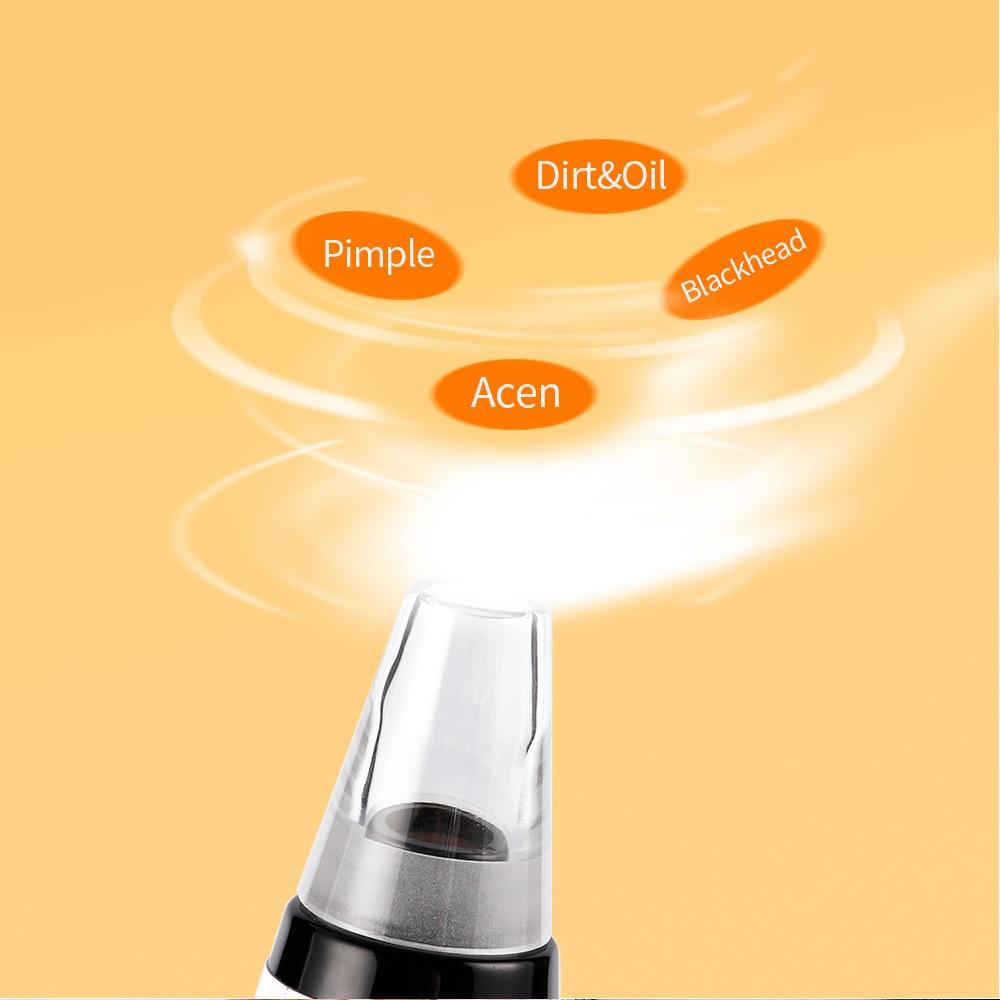 میکرودرم خانگی گلویش استایل مدل MP503