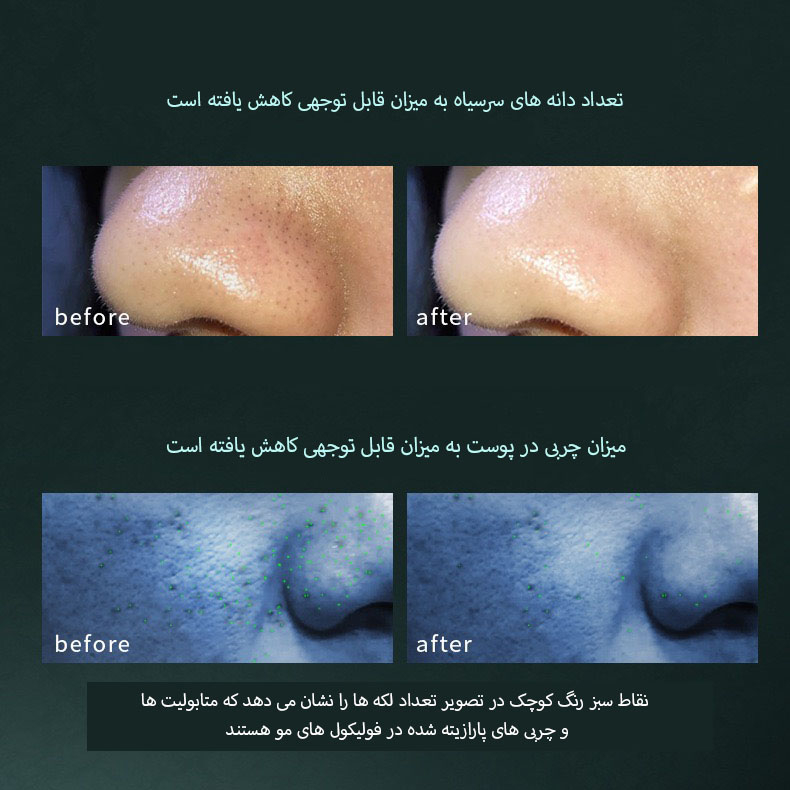 دستگاه آبرسان و پاکسازی پوست مدل lrenbang