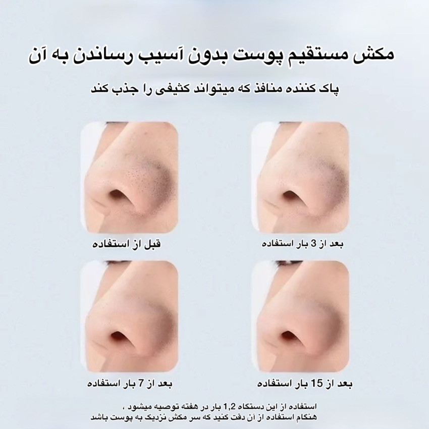 میکرودرم مدل E20