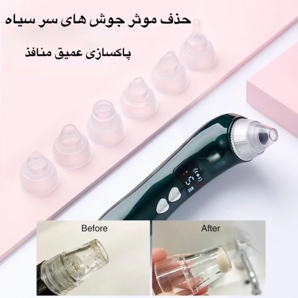 میکرودرم مدل KL-8