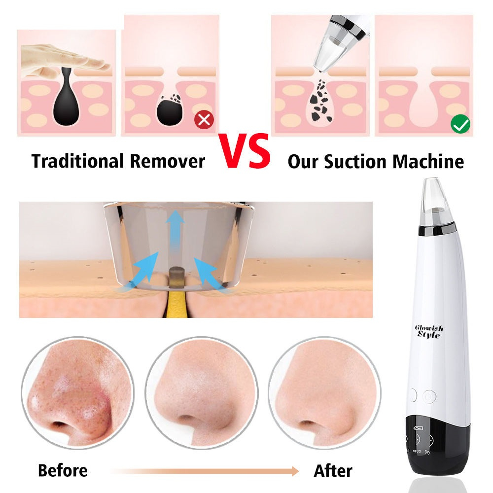 میکرودرم خانگی گلویش استایل مدل MP503