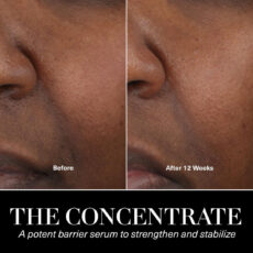 روغن صورت لامر مدل کنسانتره حجم 50 میلی لیتر