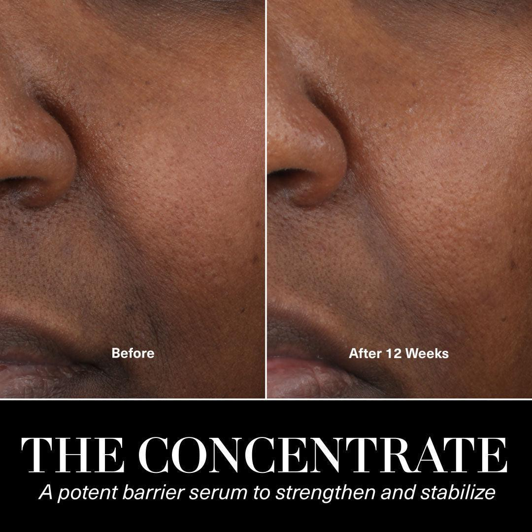 روغن صورت لامر مدل کنسانتره حجم 50 میلی لیتر