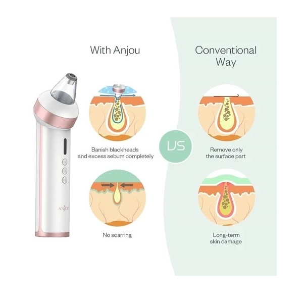 میکرودرم انجوی مدل AJ-PCA015