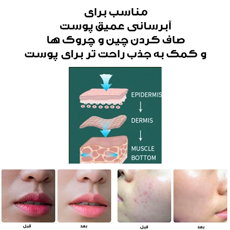 دستگاه آبرسان پوست کد ZM150