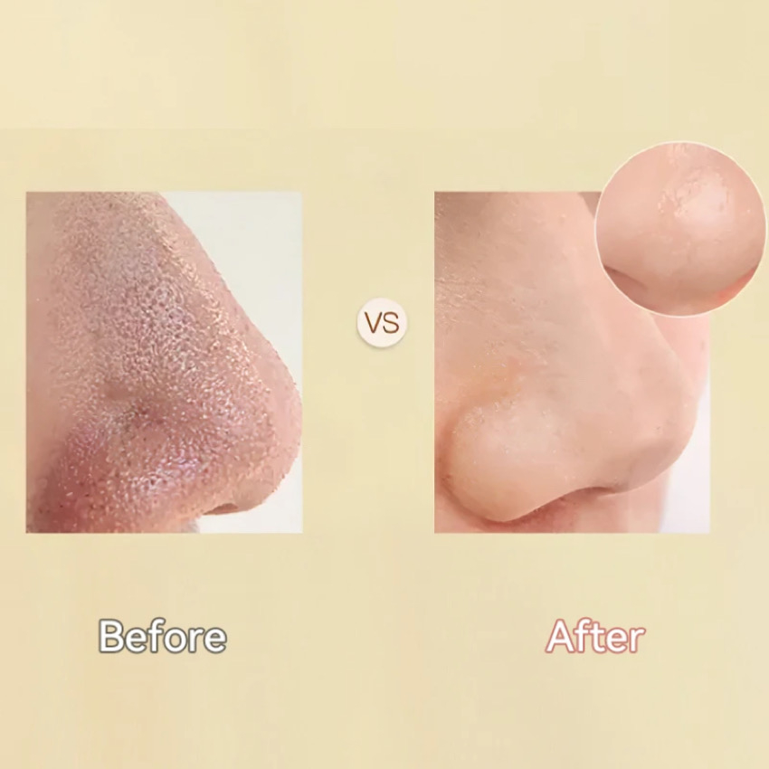 میکرودرم مدل KL-8