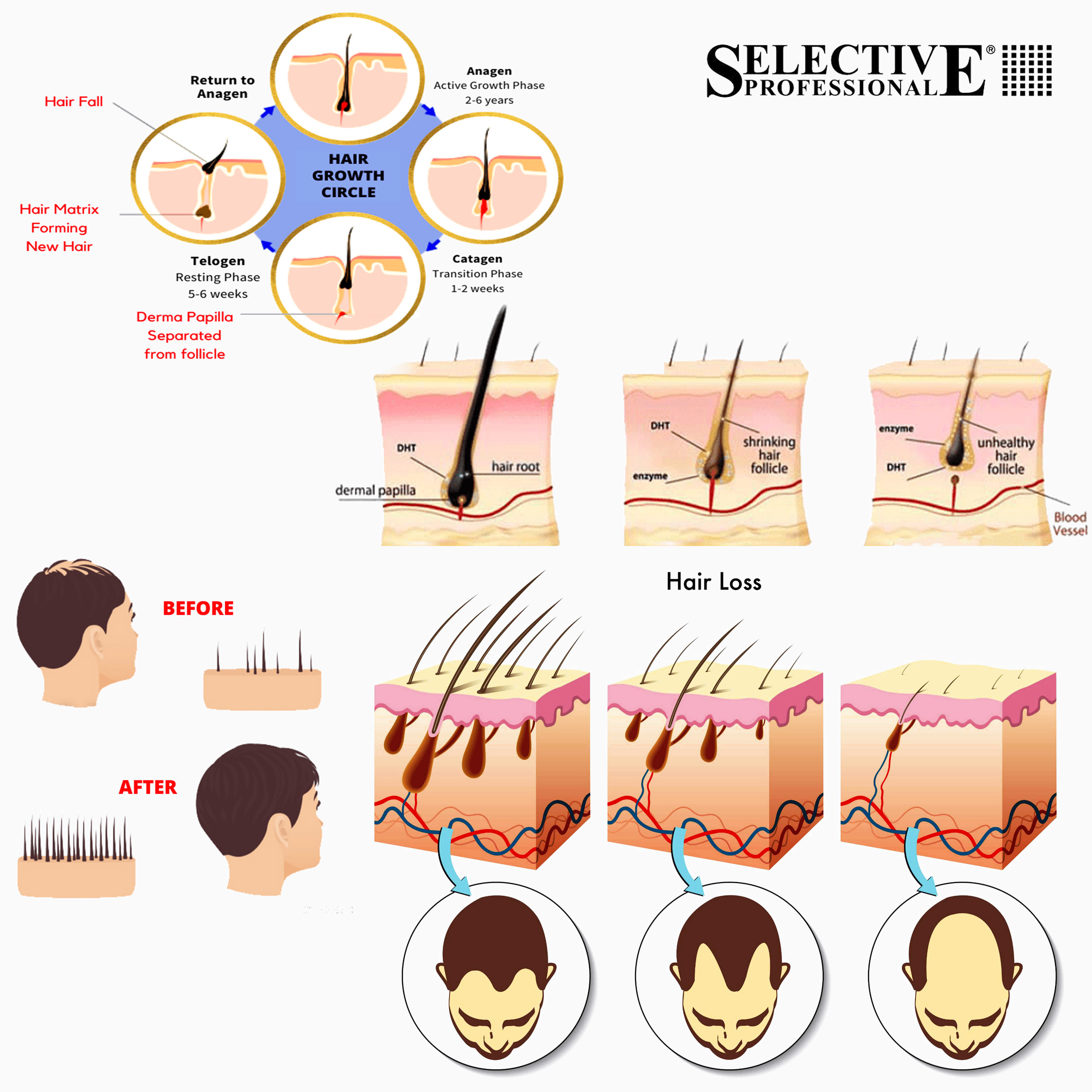 سرم ضد ریزش مو سلکتیو پروفشنال مدل Volume حجم 125 میلی لیتر