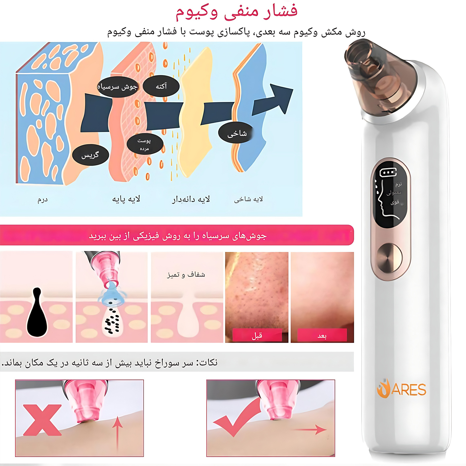 قلم پاک سازی پوست ارِس مدل RS-UF