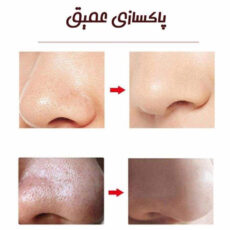 میکرودرم خانگی مدل MCOO4