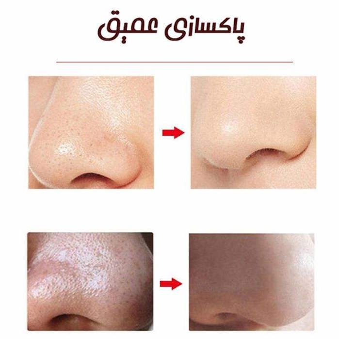 میکرودرم خانگی مدل MCOO4