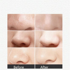 میکرودرم خانگی مدل MP503