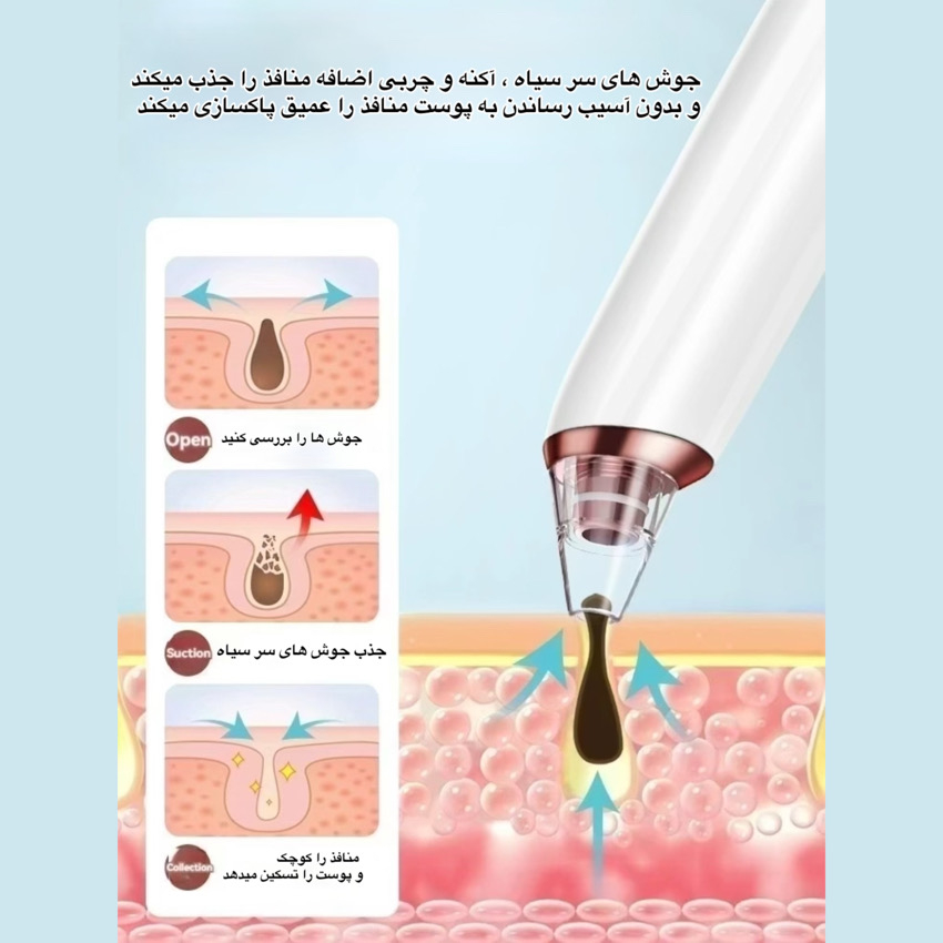 میکرودرم مدل KNY_E27