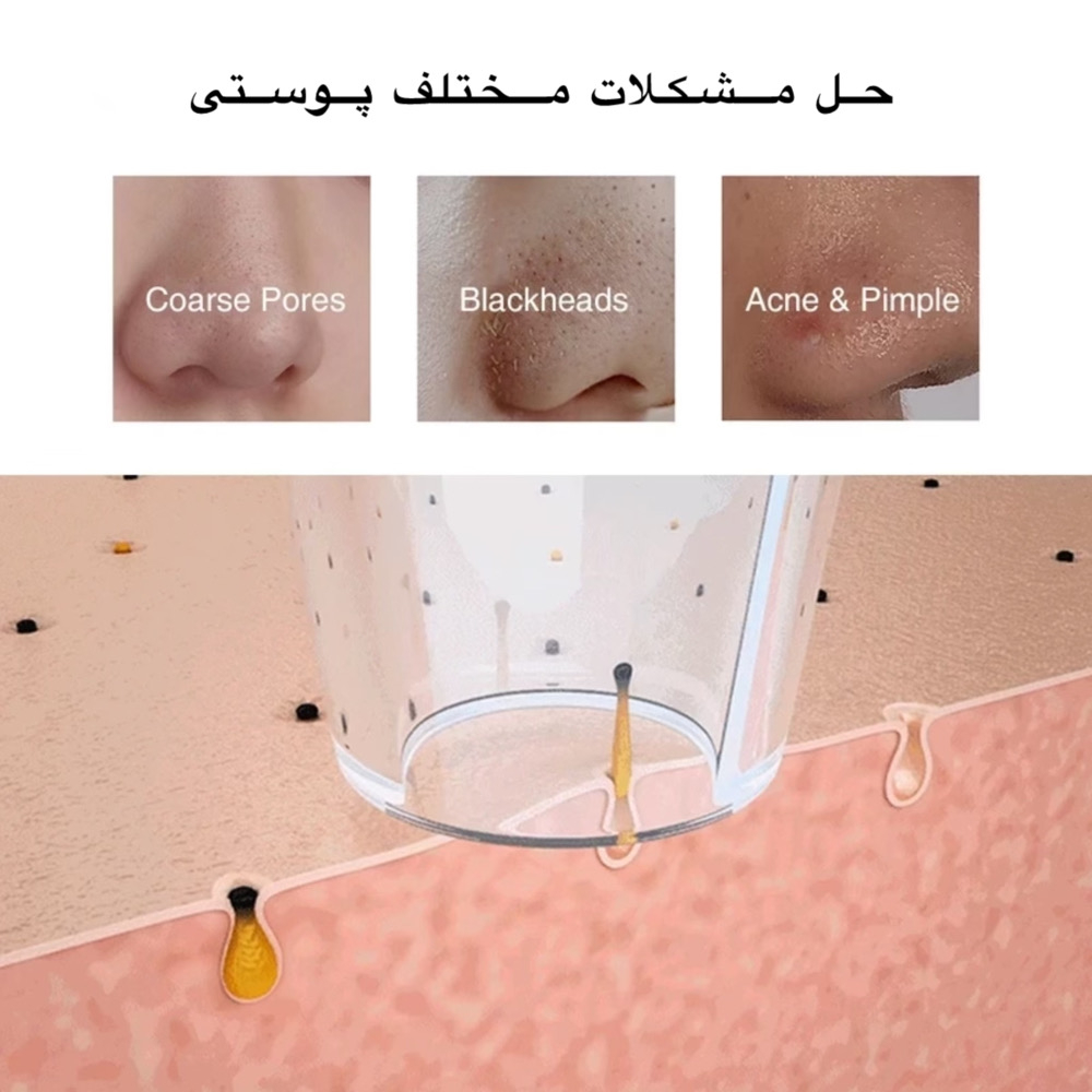 میکرودرم مدل KL-8