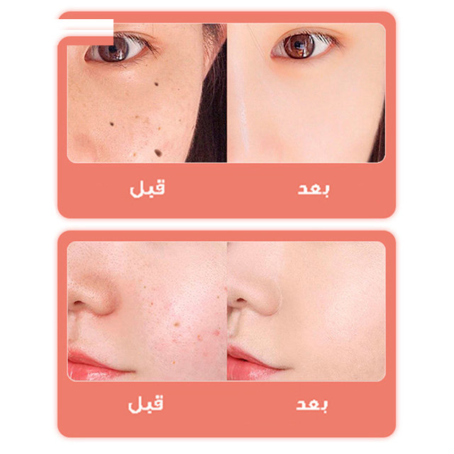 قلم پاک سازی پوست کد ZM-604