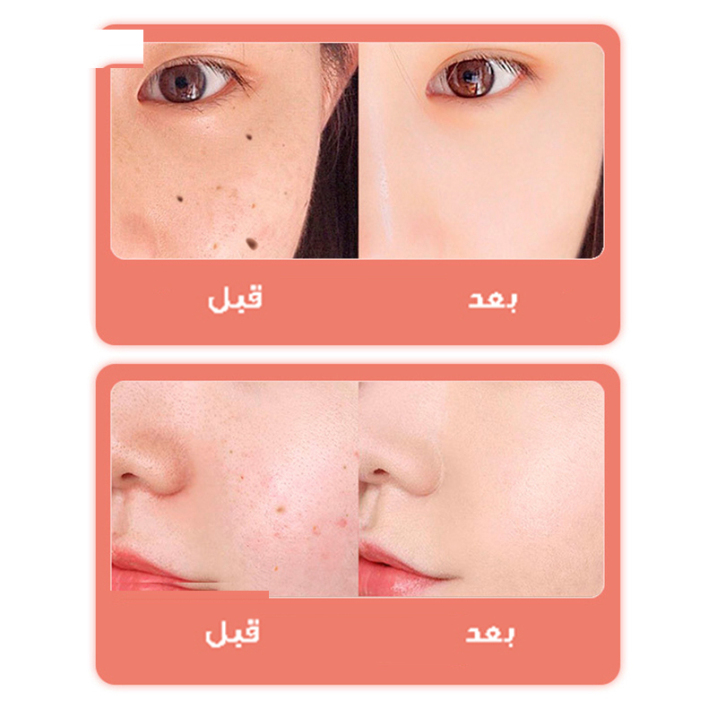 قلم پاک سازی پوست مدل دیجیتالی کد 9 سطح