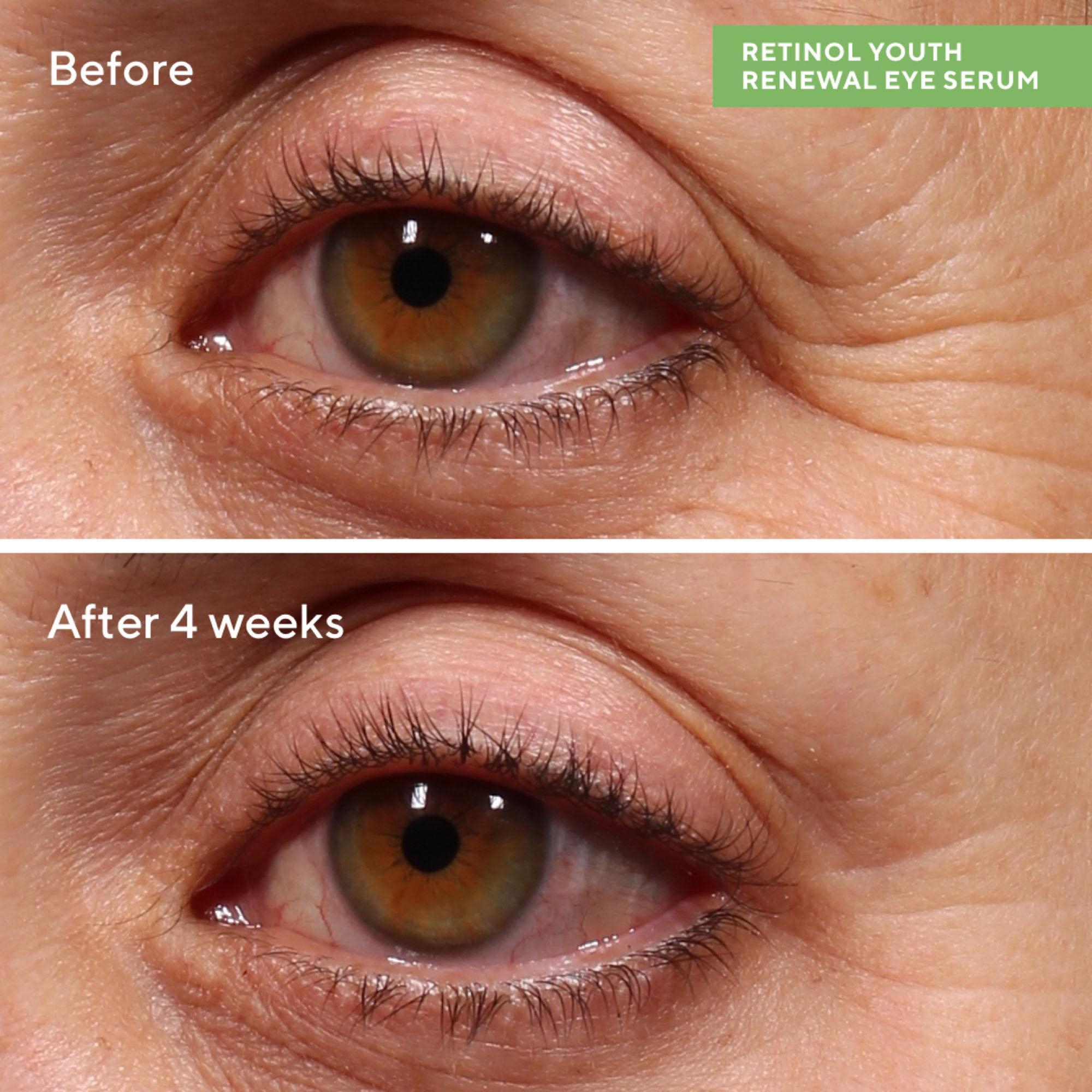 سرم دور چشم مورد مدل Retinol Youth حجم 15 میلی لیتر