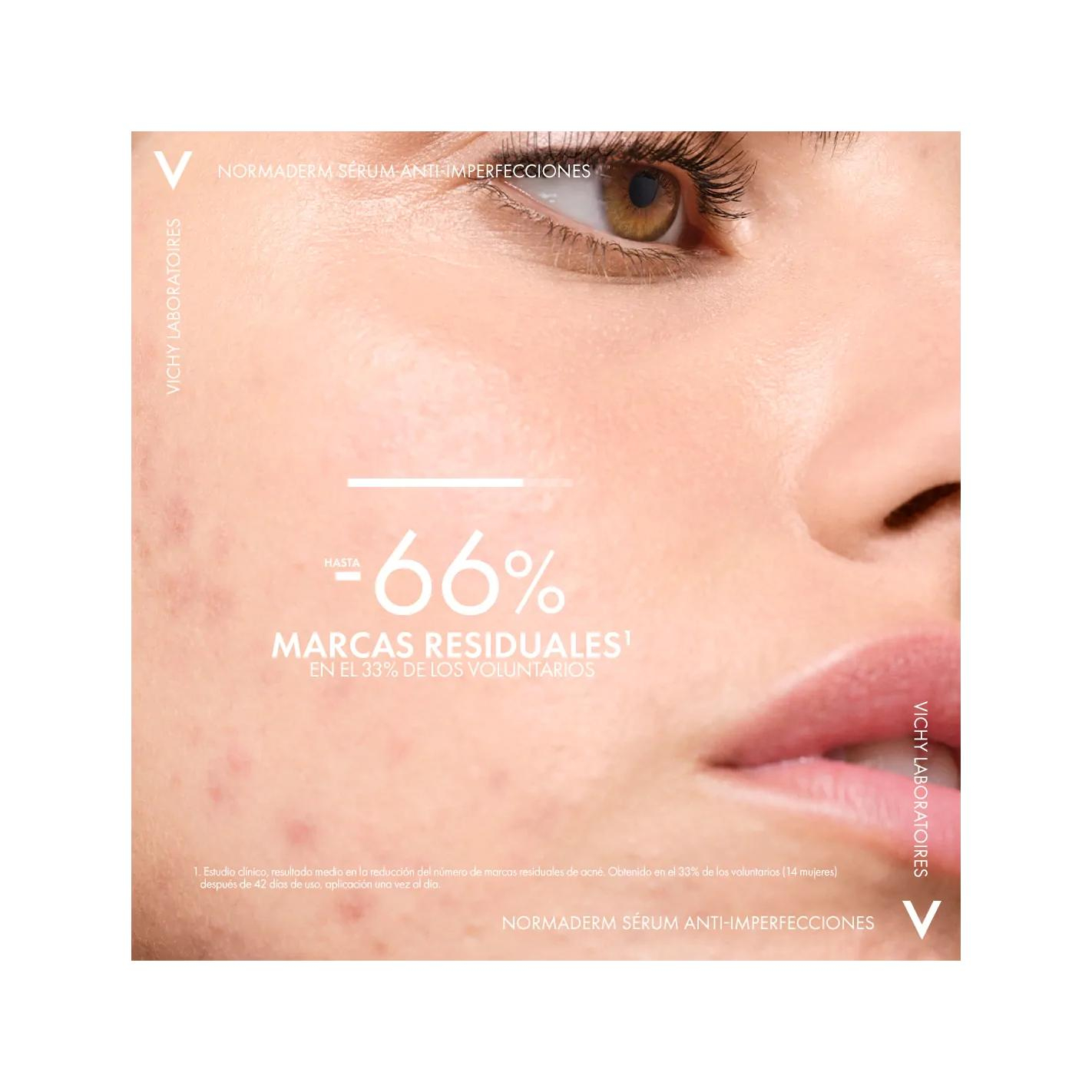 سرم ضد جوش ویشی مدل normaderm حجم 30 میلی لیتر