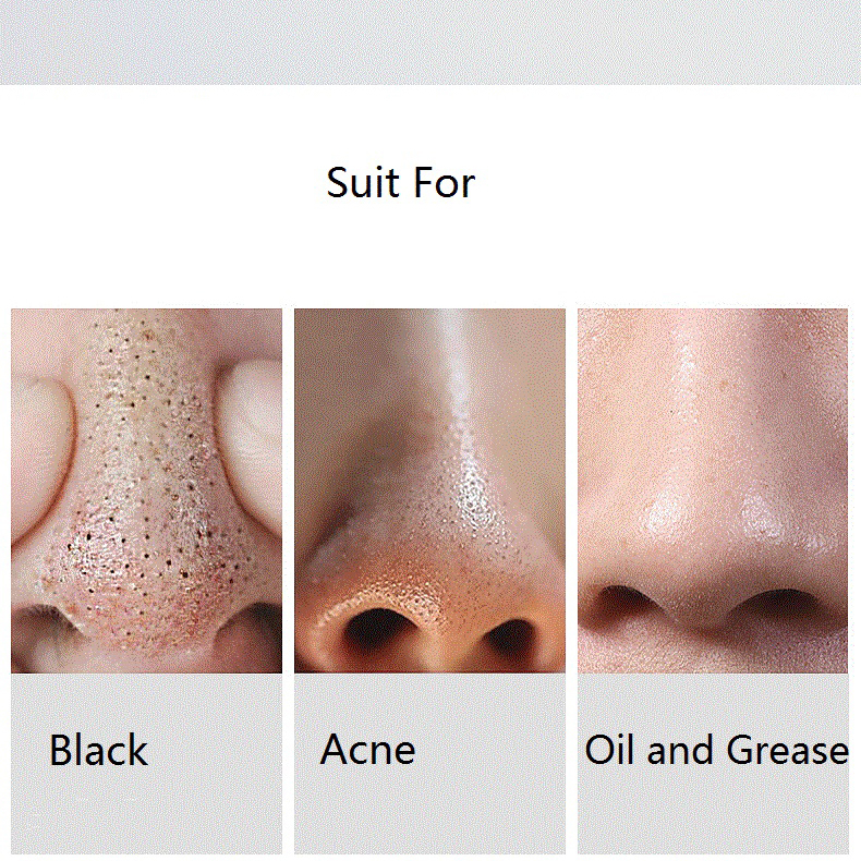 میکرودرم خانگی مدل MP503