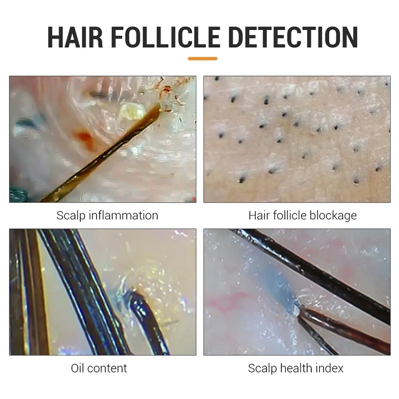 دستگاه آنالیز پوست و مو مدل BD-101C