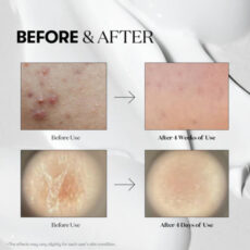 سرم روشن کننده ریدل شات مدل Cica 300 حجم 50 میلی لیتر