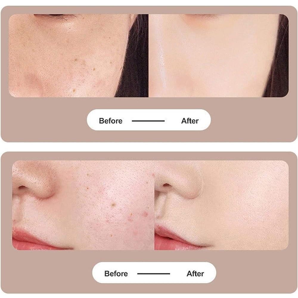 قلم پاک سازی پوست مدل dz-01