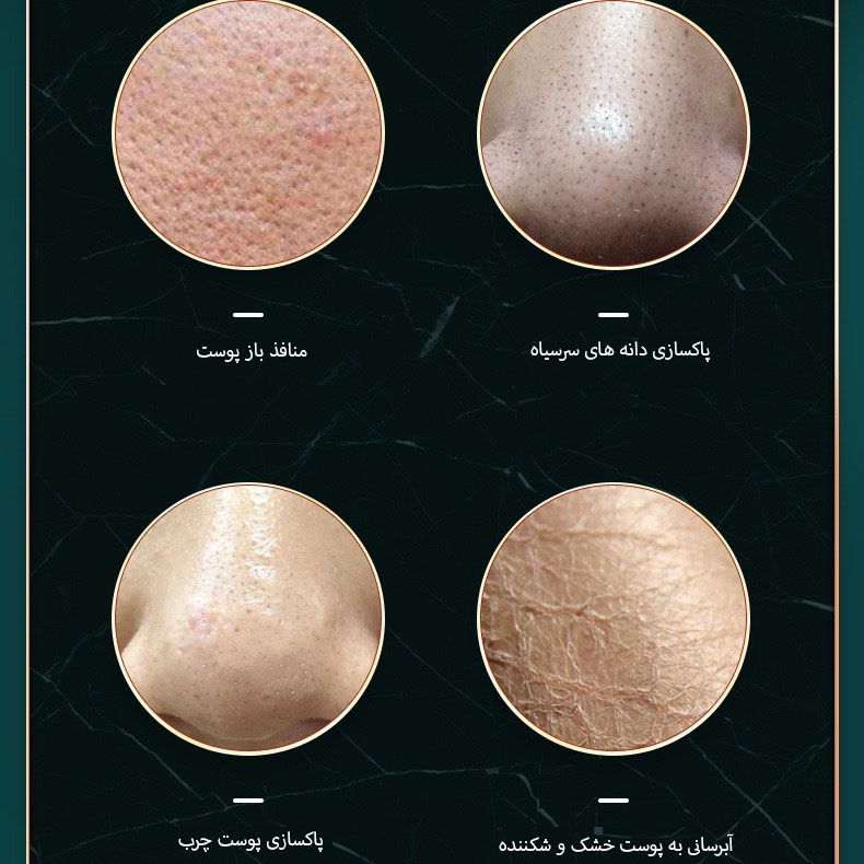 دستگاه آبرسان و پاکسازی پوست مدل lrenbang