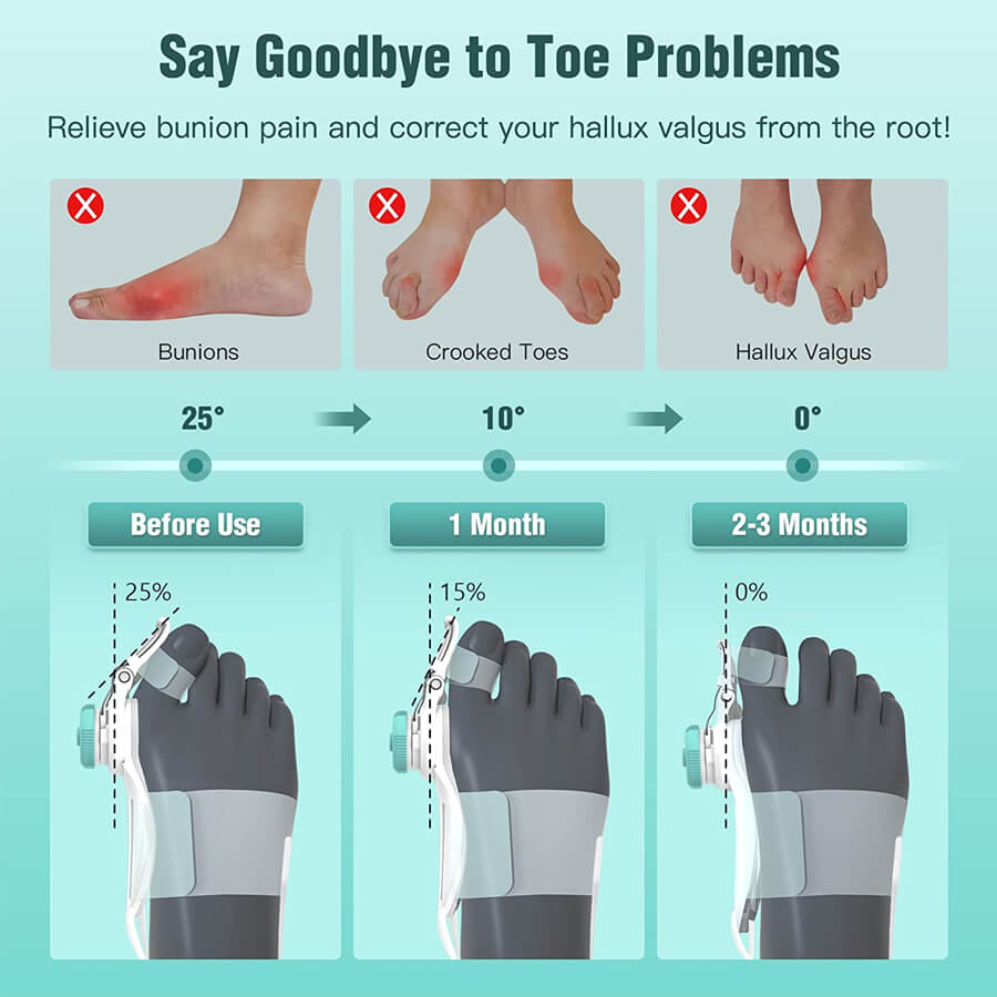 اصلاح كننده شست پا مدل 2023