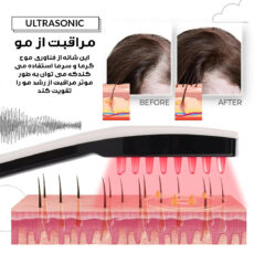 ماساژور برقی سر کد 003-QC