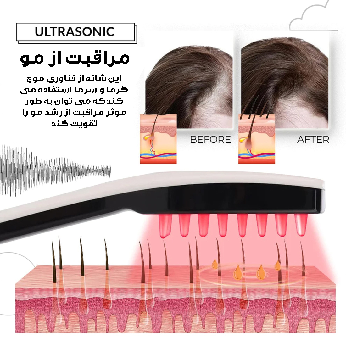 ماساژور برقی سر کد 003-QC