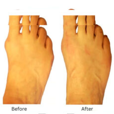 پد هالوکس مدل قابل تنظیم