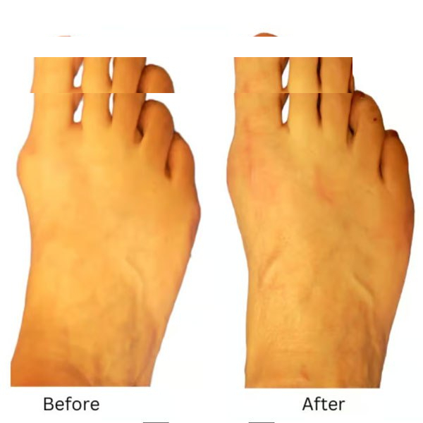 پد هالوکس مدل قابل تنظیم