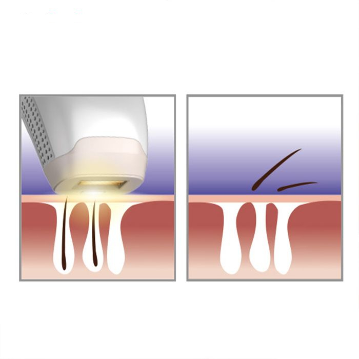 لیزر موهای زائد تاچ بیوتی مدل TB1755
