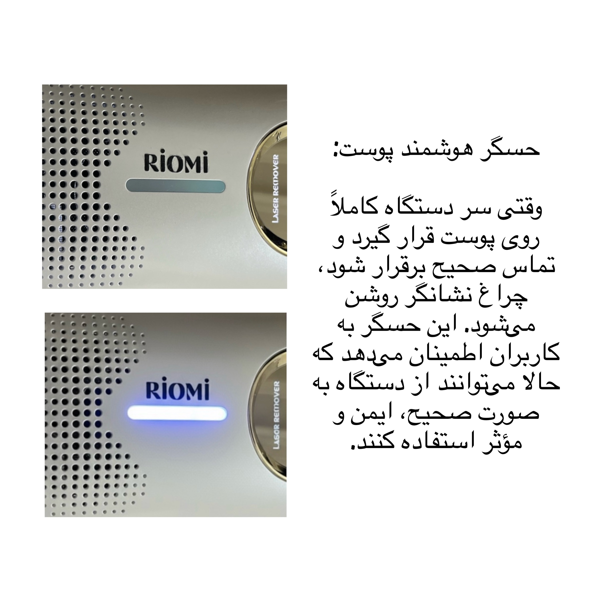 لیزر موهای زائد بدن ریومی مدل ULTRA-LUX9