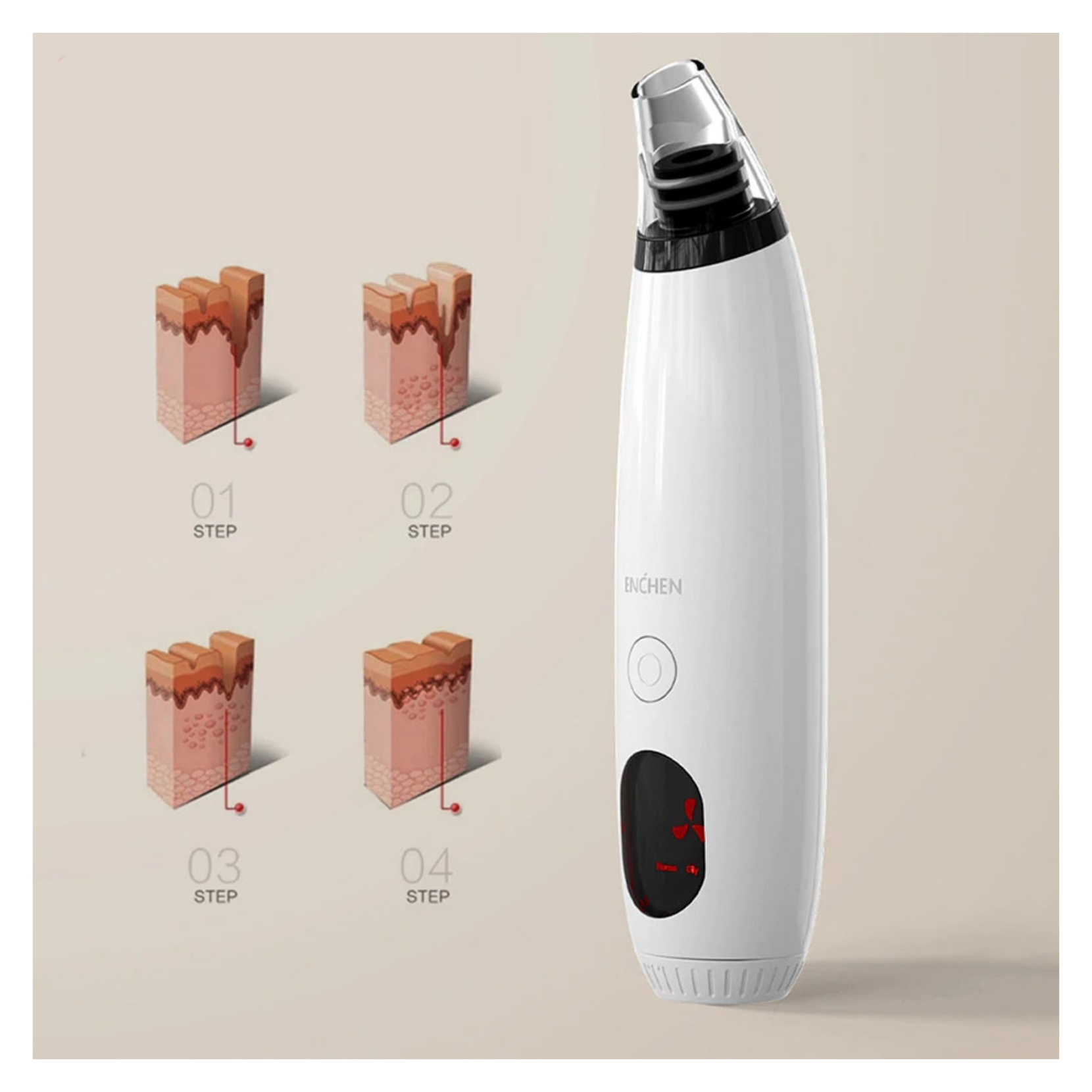 میکرودرم ان شن مدل Mi EB1001