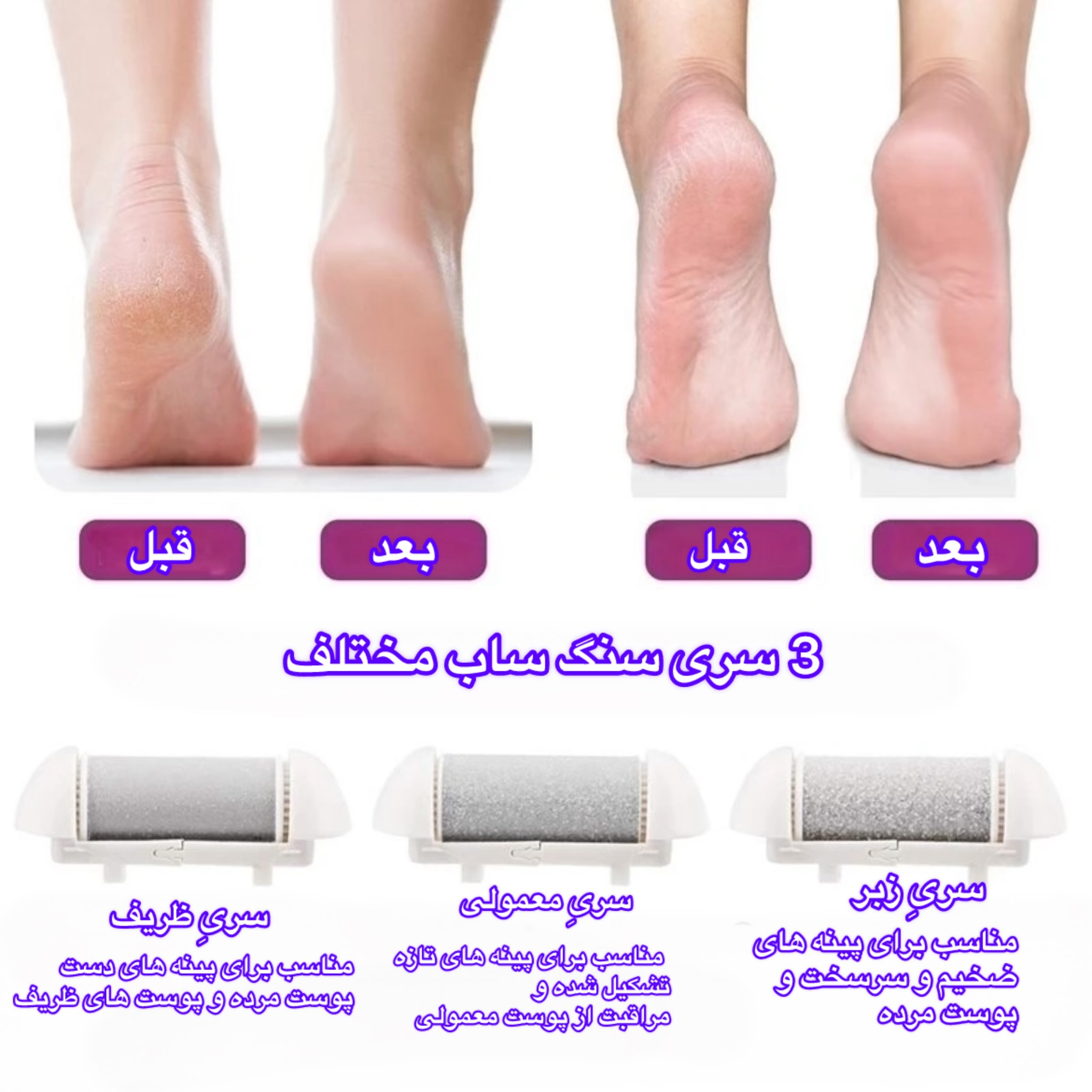 سنگ پا برقی مدل ZCAO-14